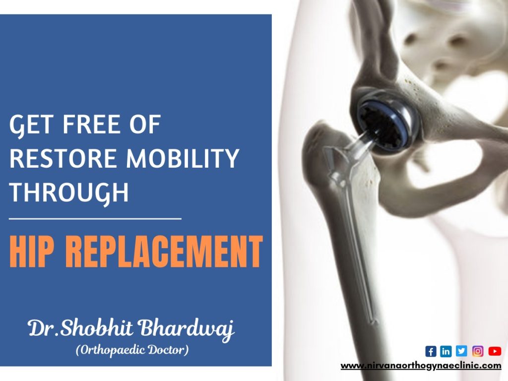 Total Hip Replacement By Dr. Shobhit Bhardwaj, Best Orthopaedic Surgeon in Noida